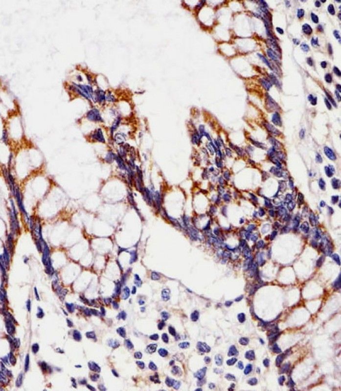 IHC-P