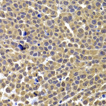 Immunohistochemistry - ARID3A Polyclonal Antibody (144-07668)
