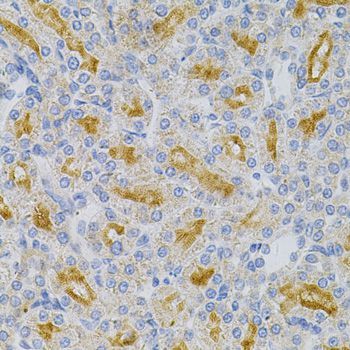 Immunohistochemistry - MYD88 Polyclonal Antibody (144-60032)