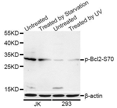 Western blot - Phospho-BCL2-S70 pAb (144-50575)