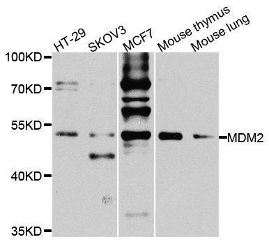 Western blot - MDM2 antibody (144-013327)