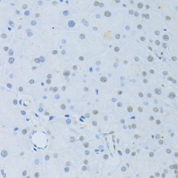 Immunohistochemistry - POLR2A Polyclonal Antibody (144-011181)