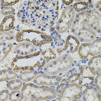 Immunohistochemistry - PTPRC antibody (144-02115)