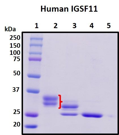 SDS-PAGE