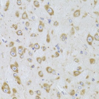 Immunohistochemistry - [KO Validated] EEF1B2 Polyclonal Antibody (144-06580)
