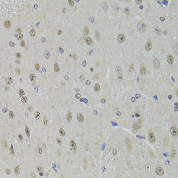 Immunohistochemistry - DDX1 Polyclonal Antibody (144-06575)