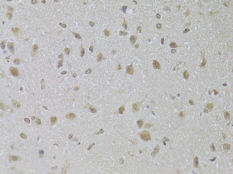 Immunohistochemistry - [KO Validated] CSNK1E Polyclonal Antibody (144-01796)