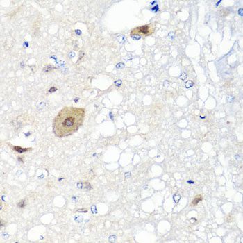 Immunohistochemistry - FGF13 antibody (144-07895)