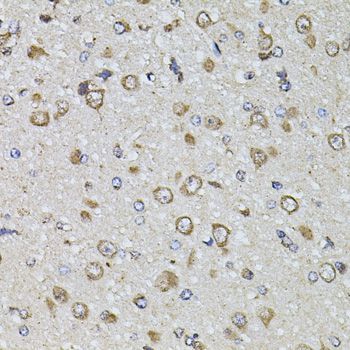 Immunohistochemistry - FGF2 Polyclonal Antibody (144-00235)