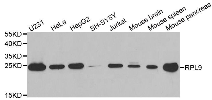 Western blot - RPL9 antibody (144-013632)