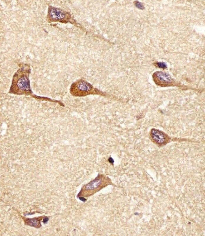IHC-P