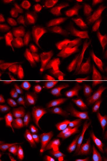 Immunofluorescence - HMMR antibody (144-012445)