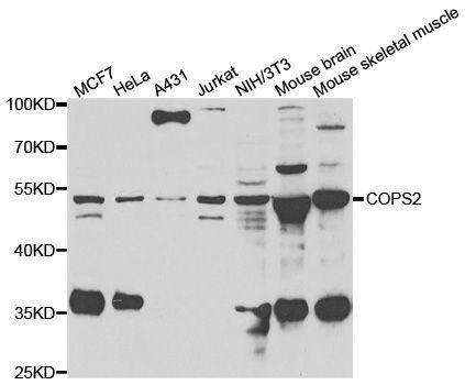 Western blot - COPS2 Polyclonal Antibody (144-07037)