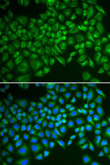 Immunofluorescence - SELE antibody (144-02191)