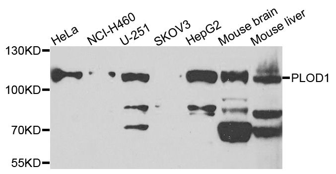 Western blot - PLOD1 antibody (144-07919)