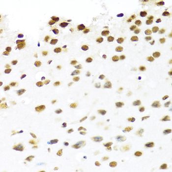 Immunohistochemistry - PRPF19 Polyclonal Antibody (144-12590)