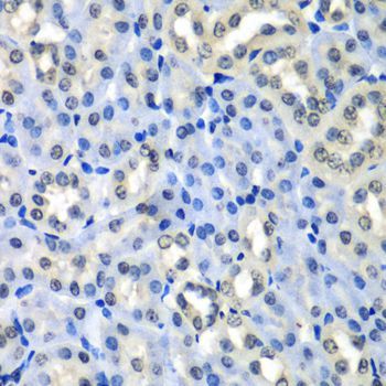 Immunohistochemistry - H2AFZ antibody (144-06614)