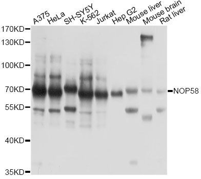 Western blot - NOP58 antibody (144-014129)