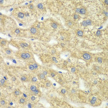 Immunohistochemistry - DLD antibody (144-60270)