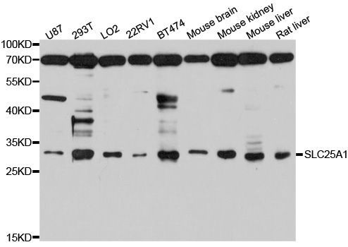 Western blot - SLC25A1 Polyclonal Antibody (144-010247)
