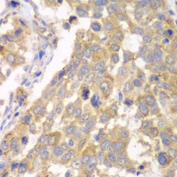 Immunohistochemistry - PFKM antibody (144-05477)