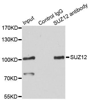 Immunohistochemistry - [KO Validated] SUZ12 Polyclonal Antibody (144-07786)