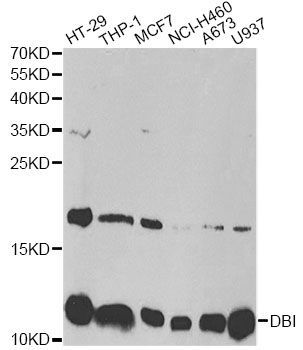 Western blot - DBI antibody (144-60267)
