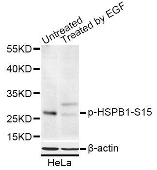 Western blot - Phospho-HSPB1-S15 pAb (144-50040)