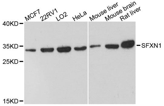 Western blot - SFXN1 antibody (144-12954)