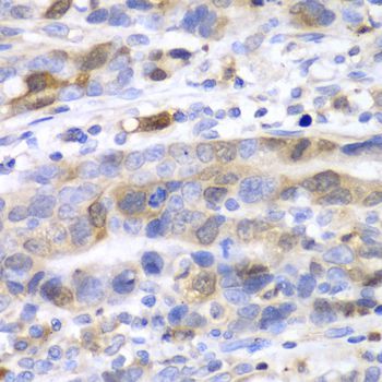 Immunohistochemistry - UBE2C Polyclonal Antibody (144-05499)