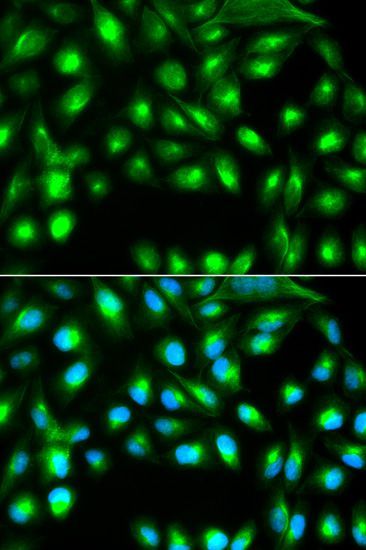 Immunofluorescence - GEMIN2 antibody (144-03082)