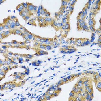 Immunohistochemistry - NFKB1 Polyclonal Antibody (144-11160)