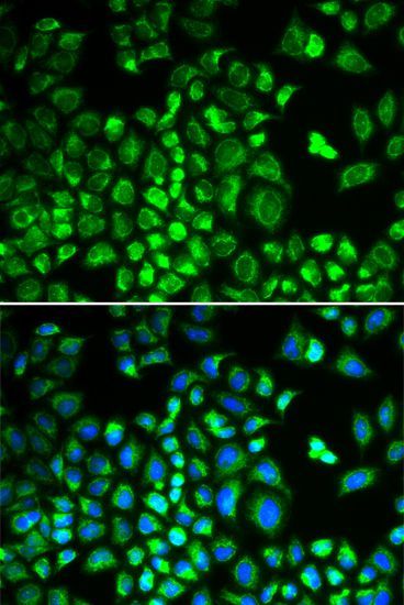 Immunohistochemistry - HAX1 Polyclonal Antibody (144-05551)