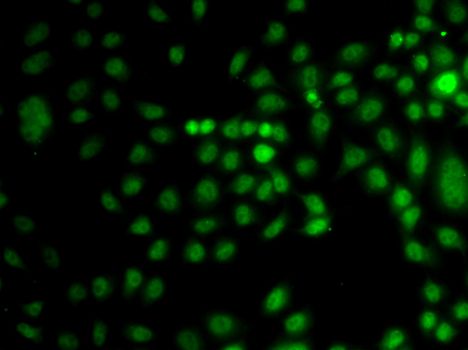 Immunofluorescence - TRPS1 antibody (144-07743)