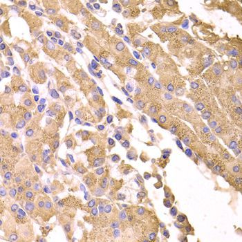 Immunohistochemistry - SUFU Polyclonal Antibody (144-06757)