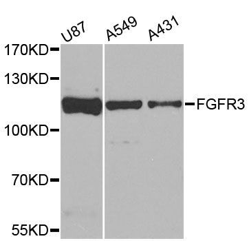 Western blot - FGFR3 Polyclonal Antibody (144-00404)