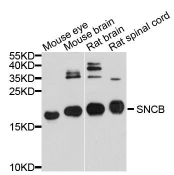 Western blot - SNCB Polyclonal Antibody (144-010443)