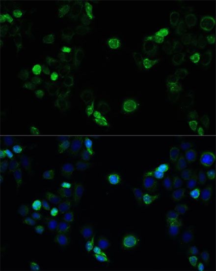 Immunofluorescence - ABCC4 Polyclonal Antibody (144-02198)