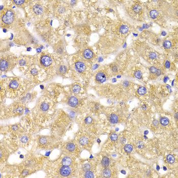Immunohistochemistry - GPD2 Antibody (144-06611)