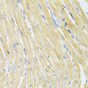 Immunohistochemistry - GLRX Antibody (144-05315)