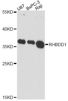 Western blot - RHBDD1 Polyclonal Antibody (144-60646)