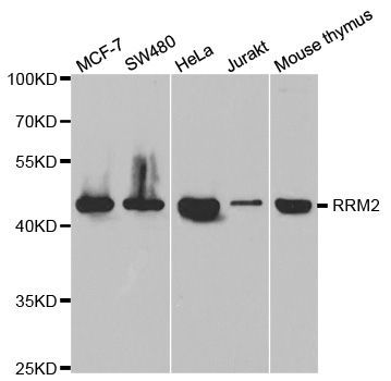 Western blot - RRM2 Polyclonal Antibody (144-05255)
