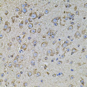 Immunohistochemistry - CPOX antibody (144-03807)