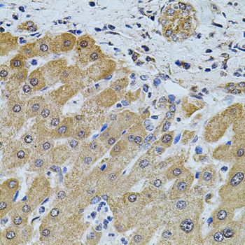 Immunohistochemistry - FOXO3 Polyclonal Antibody (144-00102)