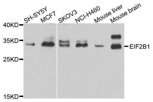 Western blot - EIF2B1 Polyclonal Antibody (144-07892)
