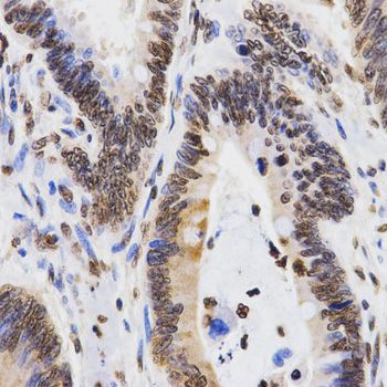 Immunohistochemistry - DiMethyl-Histone H3-K9 antibody (144-02359)
