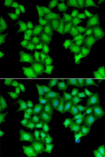 Immunofluorescence - CPSF3L antibody (144-06566)