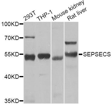 Western blot - SEPSECS Polyclonal Antibody (144-07103)