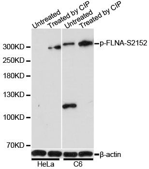 Western blot - Phospho-FLNA-S2152 antibody (144-61518)
