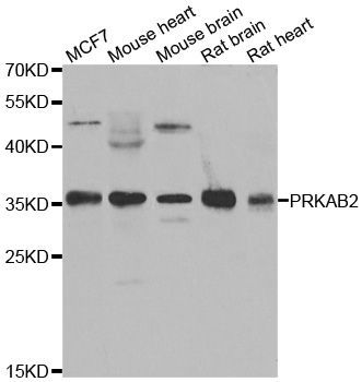 Western blot - PRKAB2 antibody (144-06952)